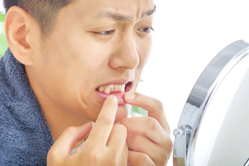 歯茎が腫れたらどうしたらいい？ご自宅での応急処置